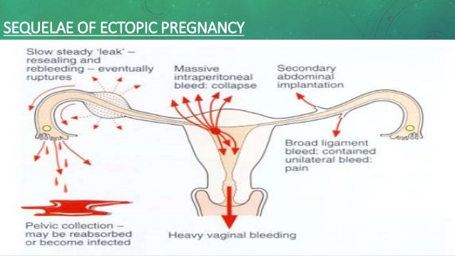 what can cause vaginal bleeding Naked grandma hidden camera